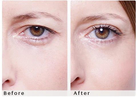 DISCONTINUED -Beauty Eyelift - Large | Wonderstripes
