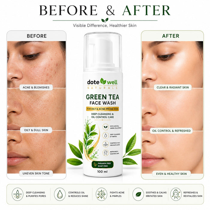 Green Tea Face Wash for Oily & Acne-Prone Skin | Deep Cleansing & Oil Control Care | 100 ml