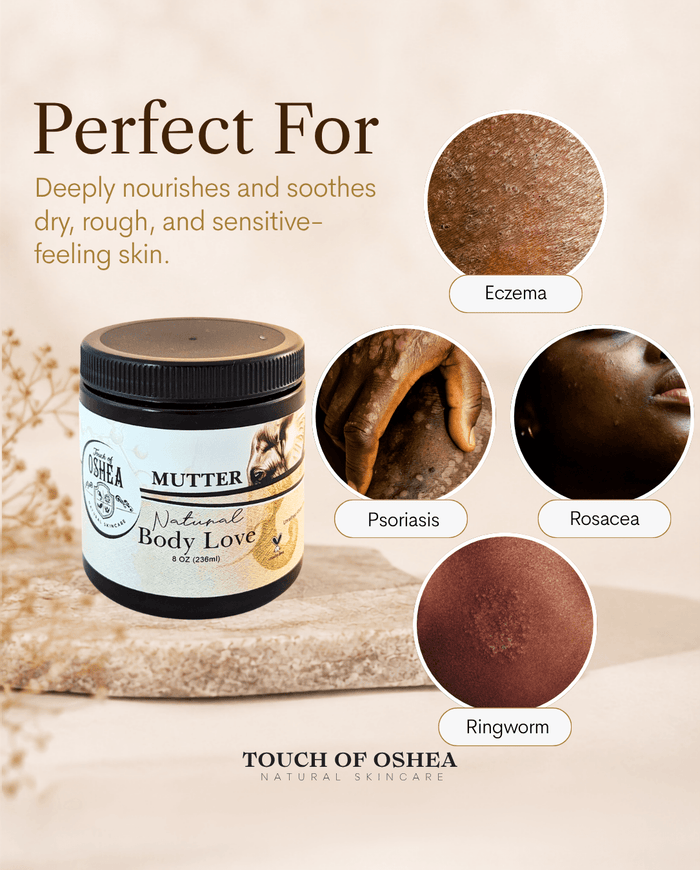 OShea Mutter – Eczema Relief Butter