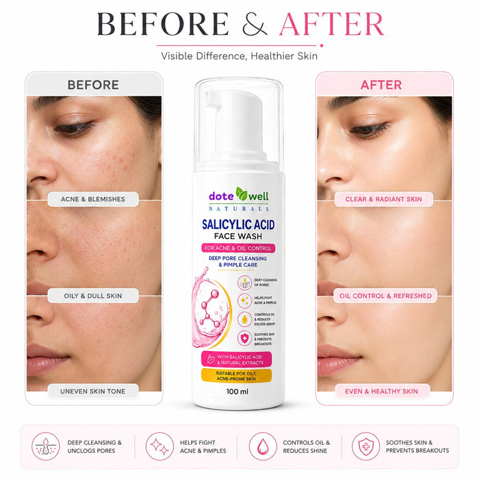 Salicylic Acid Face Wash for Acne & Oil Control | Deep Pore Cleansing & Pimple Care | 100 ml